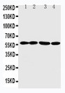 ANGPTL1 Antibody - WB of ANGPTL1 antibody. All lanes: Anti-ANGPTL1 at 0.5ug/ml. Lane 1: A549 Whole Cell Lysate at 40ug. Lane 2: SW620 Whole Cell Lysate at 40ug. Lane 3: MCF-7 Whole Cell Lysate at 40ug. Lane 4: MM231 Whole Cell Lysate at 40ug. Predicted bind size: 57KD. Observed bind size: 57KD.