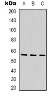 ANGPTL1 Antibody - Western blot analysis of ANGPTL1 expression in Jurkat (A); MCF7 (B); K562 (C) whole cell lysates.