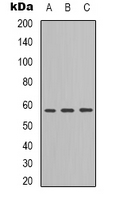 ANGPTL1 Antibody - Western blot analysis of ANGPTL1 expression in MCF7 (A); mouse heart (B); mouse kidney (C) whole cell lysates.