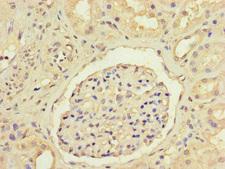 ANGPTL1 Antibody - Immunohistochemistry of paraffin-embedded human kidney tissue at dilution of 1:100