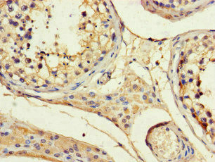 ANGPTL1 Antibody - Immunohistochemistry of paraffin-embedded human testis tissue at dilution of 1:100