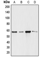 ANGPTL1 Antibody - Western blot analysis of ANGPTL1 expression in SW620 (A); A549 (B); MCF7 (C); SGC (D) whole cell lysates.