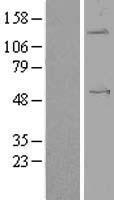 ANGPTL1 Protein - Western validation with an anti-DDK antibody * L: Control HEK293 lysate R: Over-expression lysate