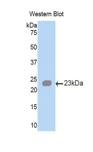 ANGPTL2 / ARP2 Antibody - Western blot of ANGPTL2 / ARP2 antibody.