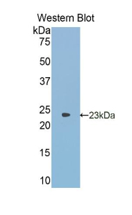 ANGPTL2 / ARP2 Antibody - Western blot of recombinant ANGPTL2 / ARP2.  This image was taken for the unconjugated form of this product. Other forms have not been tested.
