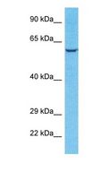 ANGPTL2 / ARP2 Antibody - Western blot of ANGL2 Antibody with human HeLa Whole Cell lysate.  This image was taken for the unconjugated form of this product. Other forms have not been tested.