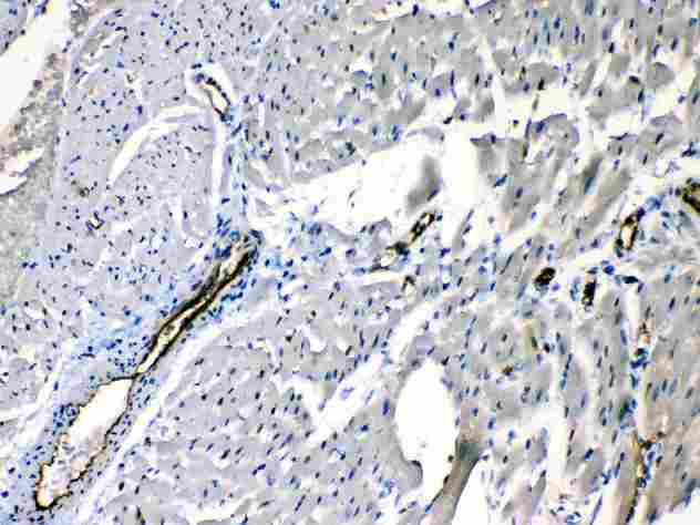 ANGPTL2 / ARP2 Antibody - ANGPTL2 was detected in paraffin-embedded sections of rat cardiac muscle tissues using rabbit anti- ANGPTL2 Antigen Affinity purified polyclonal antibody