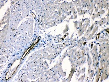 ANGPTL2 / ARP2 Antibody - IHC testing of FFPE rat heart tissue with ANGPTL2 antibody at 1ug/ml. Required HIER: steam section in pH6 citrate buffer for 20 min and allow to cool prior to testing.