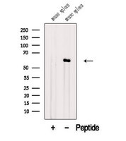 ANGPTL2 / ARP2 Antibody - Western blot analysis of extracts of mouse spleen tissue using ANGPTL2 antibody. The lane on the left was treated with blocking peptide.