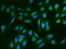 ANGPTL2 / ARP2 Antibody - Immunofluorescence staining of ANGPTL2 in U2OS cells. Cells were fixed with 4% PFA, permeabilzed with 0.1% Triton X-100 in PBS, blocked with 10% serum, and incubated with rabbit anti-Human ANGPTL2 polyclonal antibody (dilution ratio 1:200) at 4°C overnight. Then cells were stained with the Alexa Fluor 488-conjugated Goat Anti-rabbit IgG secondary antibody (green) and counterstained with DAPI (blue). Positive staining was localized to Cytoplasm.