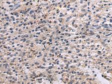 ANGPTL2 / ARP2 Antibody - Immunohistochemistry of paraffin-embedded Human brain tissue  using ANGPTL2 Polyclonal Antibody at dilution of 1:55(×200)