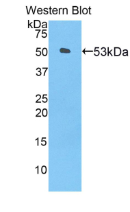 ANGPTL3 Antibody - Western blot of recombinant ANGPTL3.  This image was taken for the unconjugated form of this product. Other forms have not been tested.