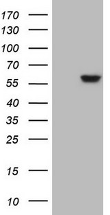 ANGPTL3 Antibody - HEK293T cells were transfected with the pCMV6-ENTRY control. (Left lane) or pCMV6-ENTRY ANGPTL3. (Right lane) cDNA for 48 hrs and lysed. Equivalent amounts of cell lysates. (5 ug per lane) were separated by SDS-PAGE and immunoblotted with anti-ANGPTL3.