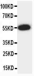 ANGPTL3 Antibody - WB of ANGPTL3 antibody. All lanes: Anti-ANGPTL3 at 0.5ug/ml. WB: A549 Whole Cell Lysate at 40ug. Predicted bind size: 45KD. Observed bind size: 55KD.