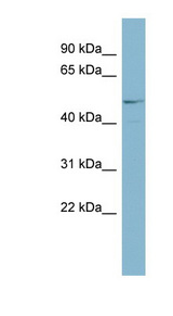 ANGPTL3 Antibody - ANGPTL3 antibody Western blot of COLO205 cell lysate.  This image was taken for the unconjugated form of this product. Other forms have not been tested.