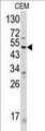 ANGPTL3 Antibody - Western blot of ANGPTL3 Antibody in CEM cell line lysates (35 ug/lane). ANGPTL3 (arrow) was detected using the purified antibody.