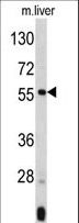ANGPTL3 Antibody - Western blot of ANGPTL3 Antibody in mouse liver tissue lysates (35 ug/lane). ANGPTL3 (arrow) was detected using the purified antibody.