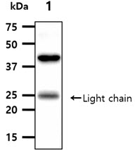 ANGPTL3 Antibody - The tissue lysates (40ug) were resolved by SDS-PAGE, transferred to PVDF membrane and probed with anti-human ANGPT5 antibody (1:1000). Proteins were visualized using a goat anti-mouse secondary antibody conjugated to HRP and an ECL detection system. Lane 1.: Mouse kidney tissue lysate