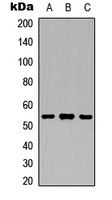 ANGPTL3 Antibody - Western blot analysis of ANGPTL3 expression in HEK293T (A); Raw264.7 (B); PC12 (C) whole cell lysates.