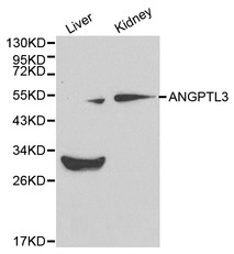 ANGPTL3 Antibody - Western blot of ANGPTL3 pAb in extracts from mouse liver and kidney tissues.