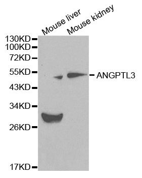 ANGPTL3 Antibody - Western blot analysis of extracts of various cell lines, using ANGPTL3 antibody at 1:1000 dilution. The secondary antibody used was an HRP Goat Anti-Rabbit IgG (H+L) at 1:10000 dilution. Lysates were loaded 25ug per lane and 3% nonfat dry milk in TBST was used for blocking.
