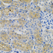 ANGPTL3 Antibody - Immunohistochemistry of paraffin-embedded mouse kidney using ANGPTL3 Antibodyat dilution of 1:100 (40x lens).