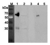 ANGPTL3 Antibody - Western blot analysis using anti-ANGPTL3 (mouse), pAb at 1:2000 dilution. 1: Mouse ANGPTL3 (FLAG-tagged) (40ng). 2: Mouse liver cell lysate (Balb/c mouse, 150 ug). 3: Mouse ANGPTL4 (FLAG-tagged). 4: Human ANGPTL3 (FLAG-tagged). 5: Human Vaspin (FLAG-tagged).