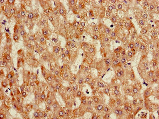 ANGPTL3 Antibody - Immunohistochemistry of paraffin-embedded human liver tissue using ANGPTL3 Antibody at dilution of 1:100