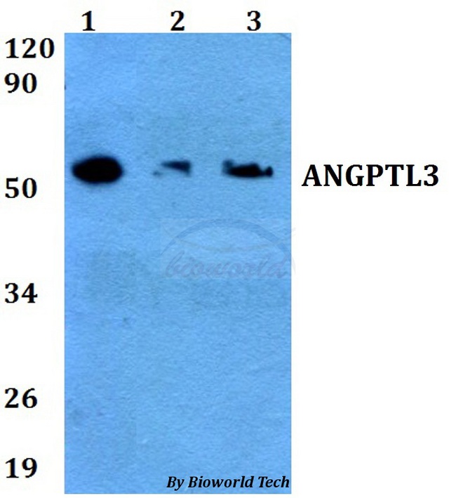 ANGPTL3 Antibody - Western blot of ANGPTL3 antibody at 1:500 dilution. Lane 1: HEK293T whole cell lysate. Lane 2: Raw264.7 whole cell lysate. Lane 3: PC12 whole cell lysate.