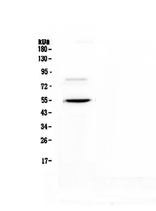 ANGPTL3 Antibody - Western blot - Anti-ANGPTL3 Picoband antibody