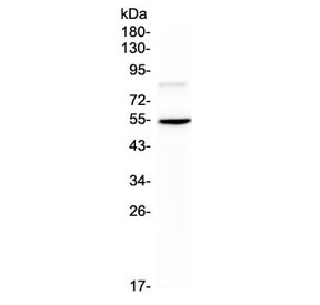 ANGPTL3 Antibody - Western blot testing of mouse HEPA1-6 cell lysate with ANGPTL3 antibody at 0.5ug/ml. Expected molecular weight 50 ~ 63 kDa depending on glycosylation level.