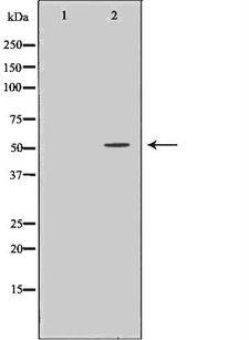 ANGPTL3 Antibody - Western blot analysis of HepG2 whole cells lysates using ANGPTL3 antibody. The lane on the left is treated with the antigen-specific peptide.