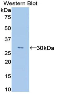 ANGPTL4 Antibody - Western blot of recombinant ANGPTL4.  This image was taken for the unconjugated form of this product. Other forms have not been tested.