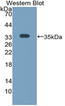 ANGPTL4 Antibody - Western blot of recombinant ANGPTL4. This image was taken for the unconjugated form of this product. Other forms have not been tested.