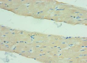 ANGPTL4 Antibody - Immunohistochemistry of paraffin-embedded human skeletal muscle using antibody at 1:100 dilution.