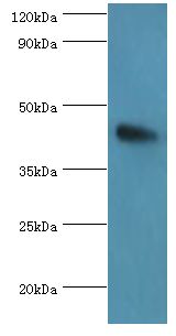 ANGPTL4 Antibody - Western blot. All lanes: Angiopoietin-related protein 4 antibody at 2 ug/ml+mouse heart tissue. Secondary antibody: Goat polyclonal to rabbit at 1:10000 dilution. Predicted band size: 45 kDa. Observed band size: 45 kDa Immunohistochemistry.