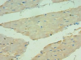 ANGPTL4 Antibody - Immunohistochemistry of paraffin-embedded human skeletal muscle using antibody at 1:100 dilution.