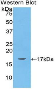 ANGPTL4 Antibody - Western blot of recombinant ANGPTL4.  This image was taken for the unconjugated form of this product. Other forms have not been tested.
