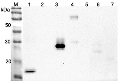 ANGPTL4 Antibody - Western blot analysis using anti-ANGPTL4 (CCD) (human), pAb at 1:2000 dilution. 1: Human ANGPTL4 (CDD) (FLAG-tagged). 2: Human ANGPTL4 (FLAG-tagged). 3: Human ANGPTL3 (CCD) (FLAG-tagged). 4: Human ANGPTL3 (FLAG-tagged). 5: Human ANGPTL3 (FLD) (FLAG-tagged). 6: Human ANGPTL2 (CCD) (FLAG-tagged). 7: Human ANGPTL5 (CCD) (FLAG-tagged).