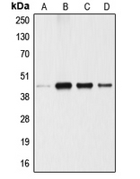 ANGPTL4 Antibody - Western blot analysis of ANGPTL4 expression in A549 (A); 293T (B); U87MG (C); SGC (D) whole cell lysates.