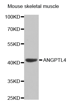 ANGPTL4 Antibody - Western blot analysis of extracts of mouse skeletal muscle, using ANGPTL4 antibody.