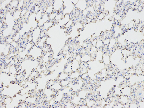 ANGPTL4 Antibody - Immunohistochemistry of paraffin-embedded rat lung using ANGPTL4 antibody at dilution of 1:100 (200x lens).