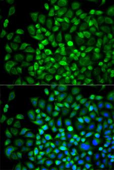 ANGPTL4 Antibody - Immunofluorescence analysis of A549 cell using ANGPTL4 antibody. Blue: DAPI for nuclear staining.