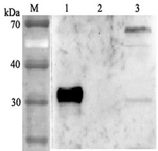 ANGPTL4 Antibody - Western blot analysis using anti-ANGPTL4 (human), pAb at 1:2000 dilution. 1: Human ANGPTL4 (FLAG-tagged). 2: Human ANGPTL6 (FLAG-tagged). 3: HepG2 cell lysate.