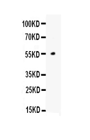 ANGPTL4 Antibody - Western blot analysis of ANGPTL4 using anti-ANGPTL4 antibody. Electrophoresis was performed on a 5-20% SDS-PAGE gel at 70V (Stacking gel) / 90V (Resolving gel) for 2-3 hours. lane 1: recombinant human ANGPTL4 protein 1ngAfter Electrophoresis, proteins were transferred to a Nitrocellulose membrane at 150mA for 50-90 minutes. Blocked the membrane with 5% Non-fat Milk/ TBS for 1.5 hour at RT. The membrane was incubated with rabbit anti-ANGPTL4 antigen affinity purified polyclonal antibody at 0.5 µg/mL overnight at 4°C, then washed with TBS-0.1% Tween 3 times with 5 minutes each and probed with a goat anti-rabbit IgG-HRP secondary antibody at a dilution of 1:10000 for 1.5 hour at RT. The signal is developed using an Enhanced Chemiluminescent detection (ECL) kit with Tanon 5200 system. A specific band was detected for ANGPTL4 at approximately 55KD. The expected band size for ANGPTL4 is at 44KD.