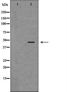 ANGPTL4 Antibody - Western blot analysis of extracts of mouse skeletal muscle using ANGPTL4 antibody. The lane on the left is treated with the antigen-specific peptide.