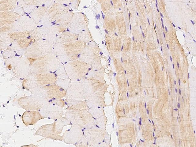 ANGPTL4 Antibody - Immunochemical staining of mouse ANGPTL4 in mouse skeletal muscle with rabbit polyclonal antibody at 1:1000 dilution, formalin-fixed paraffin embedded sections.
