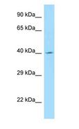 ANGPTL5 Antibody - ANGPTL5 antibody Western Blot of MCF7.  This image was taken for the unconjugated form of this product. Other forms have not been tested.