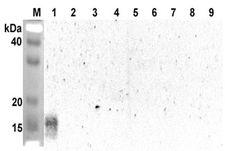 ANGPTL5 Antibody - Western blot analysis using anti-ANGPTL5 (CCD) (human), pAb at 1:2000 dilution. 1: Human ANGPTL5 (CCD) (FLAG-tagged). 2: Human ANGPTL5 (FLD) (FLAG-tagged). 3: Human ANGPTL2 (CCD) (FLAG-tagged). 4: Human ANGPTL3 (CCD) (FLAG-tagged). 5: Human ANGPTL4 (CCD) (FLAG-tagged). 6: Human ANGPTL6 (FLAG-tagged). 7: Human ANGPTL3 (FLAG-tagged). 8: Human ANGPTL4 (FLAG-tagged). 9: Human ANGPTL7 (FLAG-tagged).