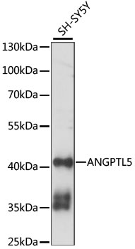 ANGPTL5 Antibody - Western blot analysis of extracts of SH-SY5Y cells, using ANGPTL5 antibody at 1:1000 dilution. The secondary antibody used was an HRP Goat Anti-Rabbit IgG (H+L) at 1:10000 dilution. Lysates were loaded 25ug per lane and 3% nonfat dry milk in TBST was used for blocking. An ECL Kit was used for detection and the exposure time was 60S.